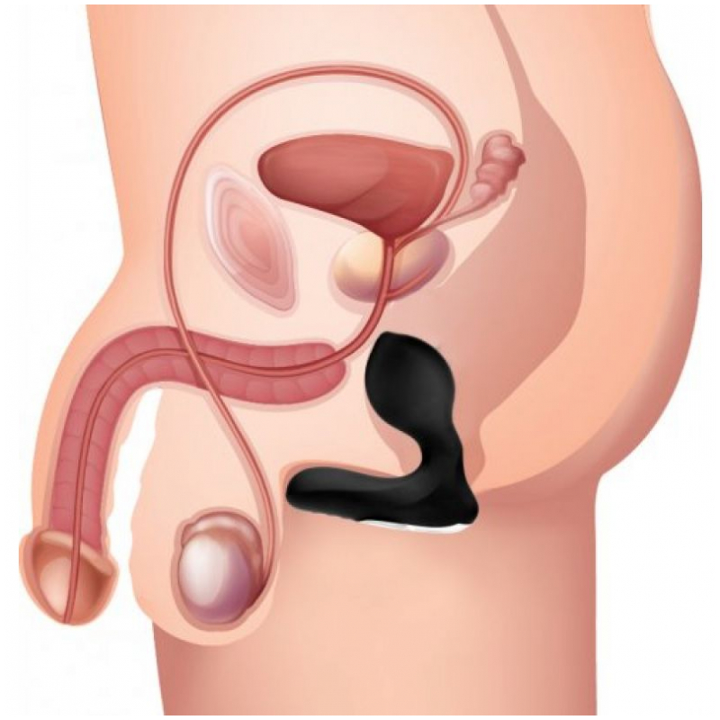 Vibrador de la próstata inflable P-Swell 12x